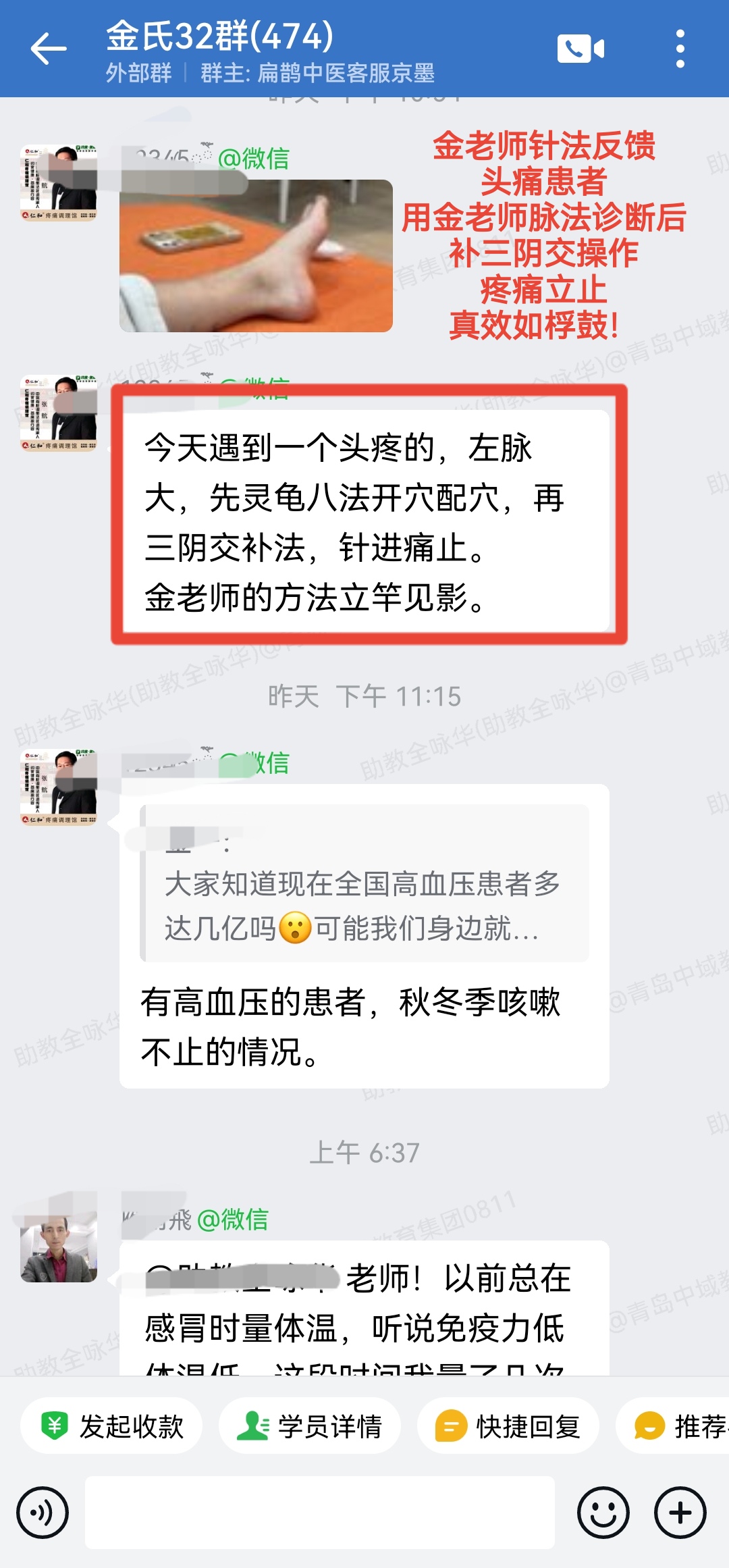 金老师升降针学员反馈：头痛患者，按照金氏脉法进针，一针止痛！