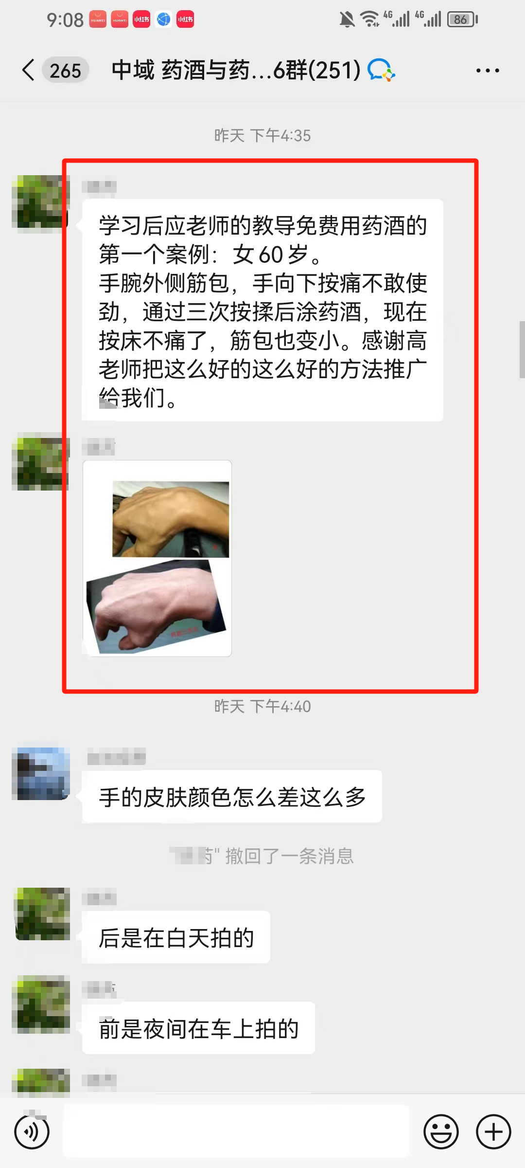 药酒与药茶学员反馈：手腕外侧筋包，手向下按痛不敢使劲，涂抹按揉三次就不痛了！