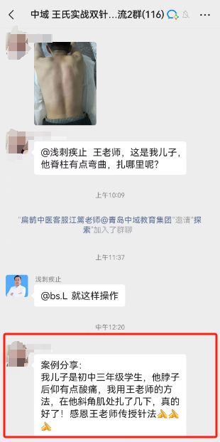 王氏实战双针术学员反馈：脖子后仰有点酸痛，在斜角肌处扎了几下，真的好了！