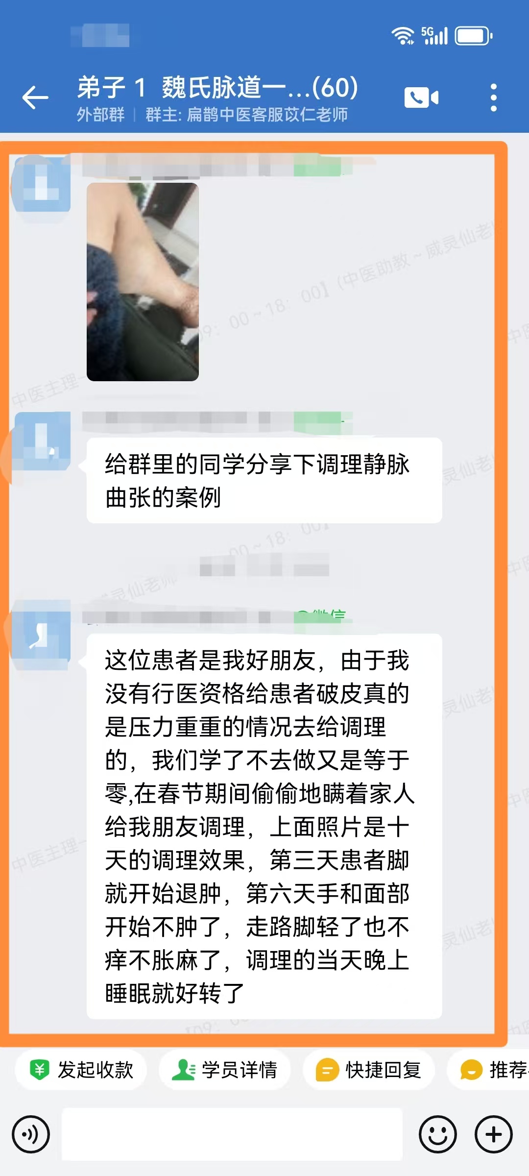 魏氏气血一针通弟子反馈：调理静脉曲张，现在脚也不肿了、走路也不麻木了