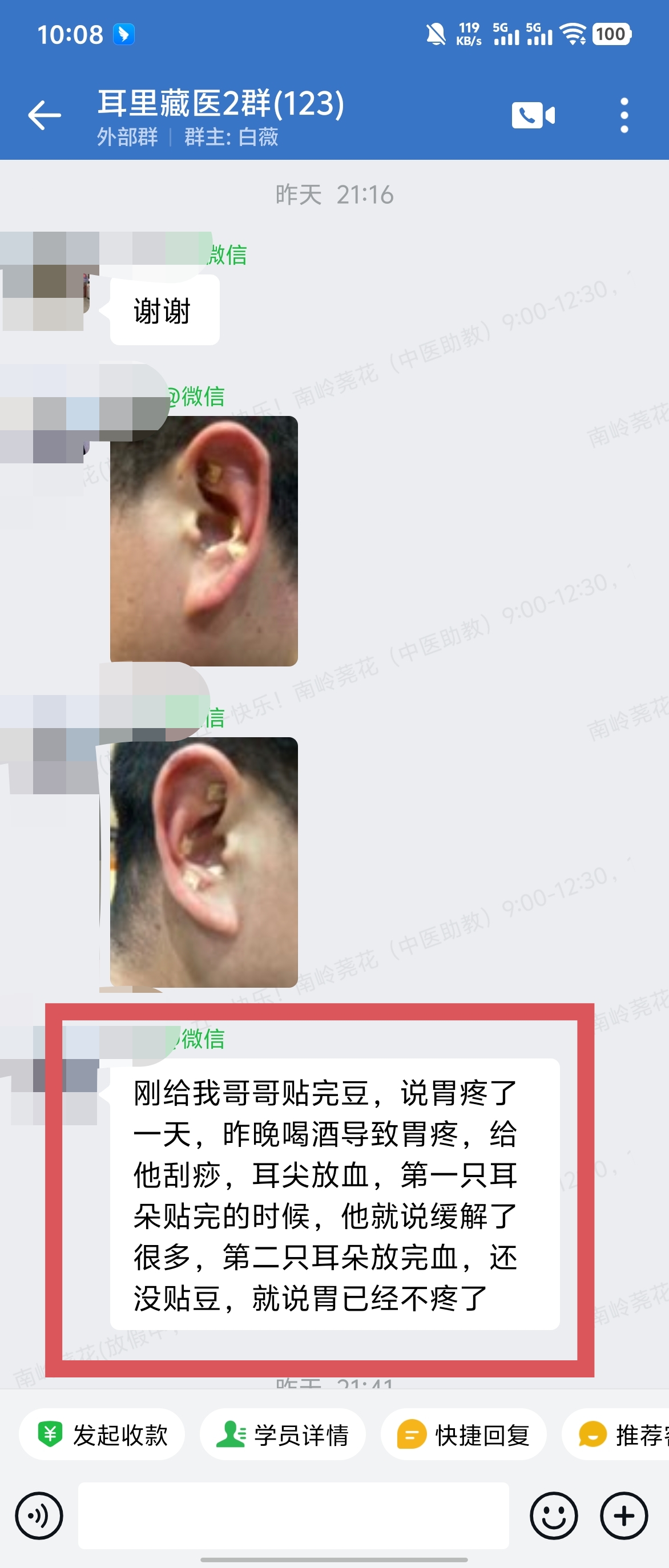 耳里藏医学员反馈：喝酒胃痛用马老师的耳穴贴豆和耳尖放血，当场胃就不疼了！