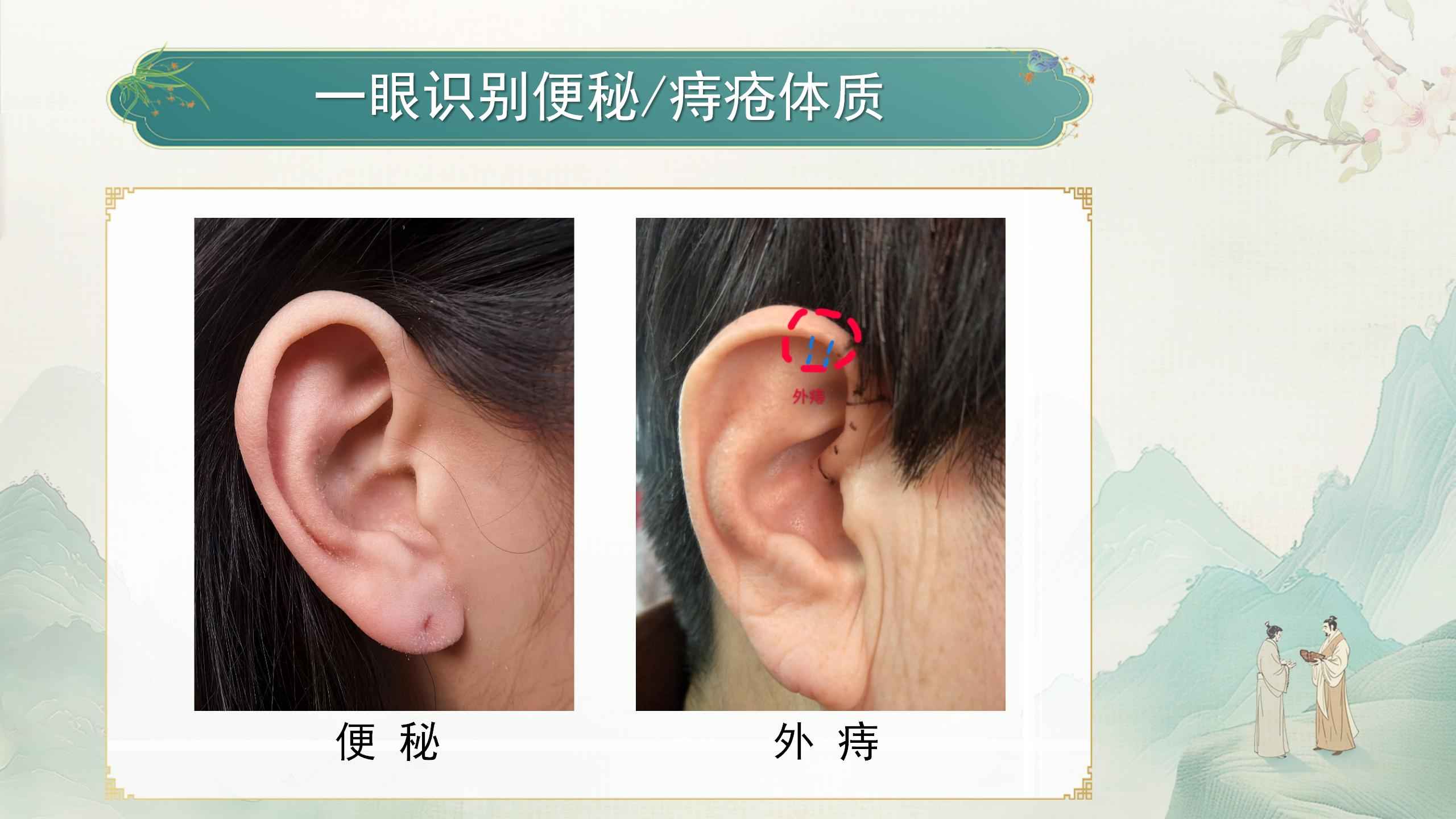 250412elcy115.jpg