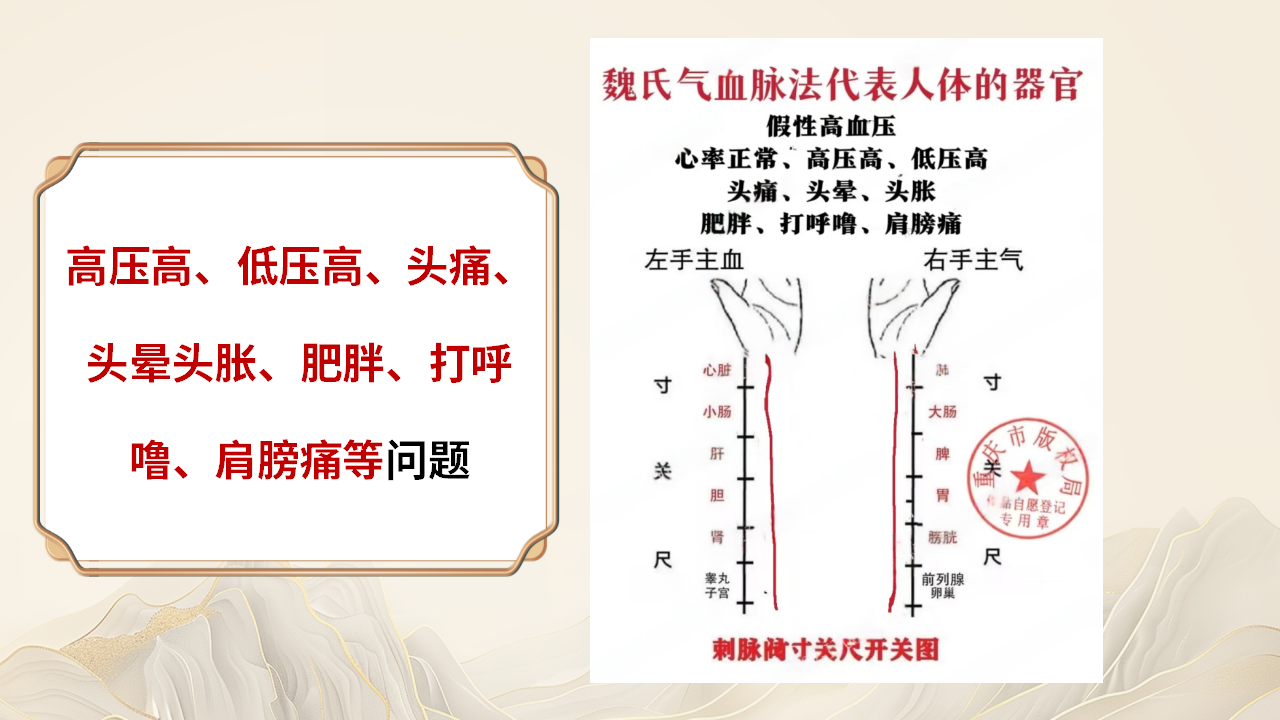 YWxpdmV1cGxvYWRwaWMtYWxpdmVyb29tLXVfNjJhODNlYjgzNTM0OV9MWVVaanRKTTBVLVJ1VWNGR3hF.png YWxpdmV1cGxvYWRwaWMtYWxpdmVyb29tLXVfNjJhODNlYjgzNTM0OV9MWVVaanRKTTBVLVJ1VWNGR3hF.png